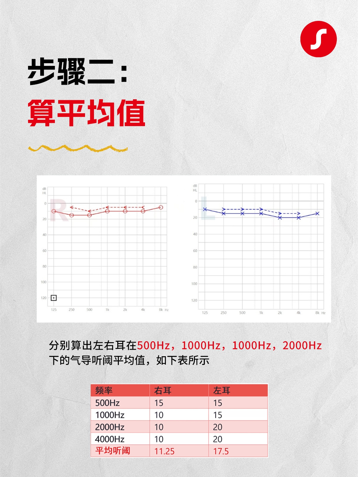 一分钟，了解自己的听损程度